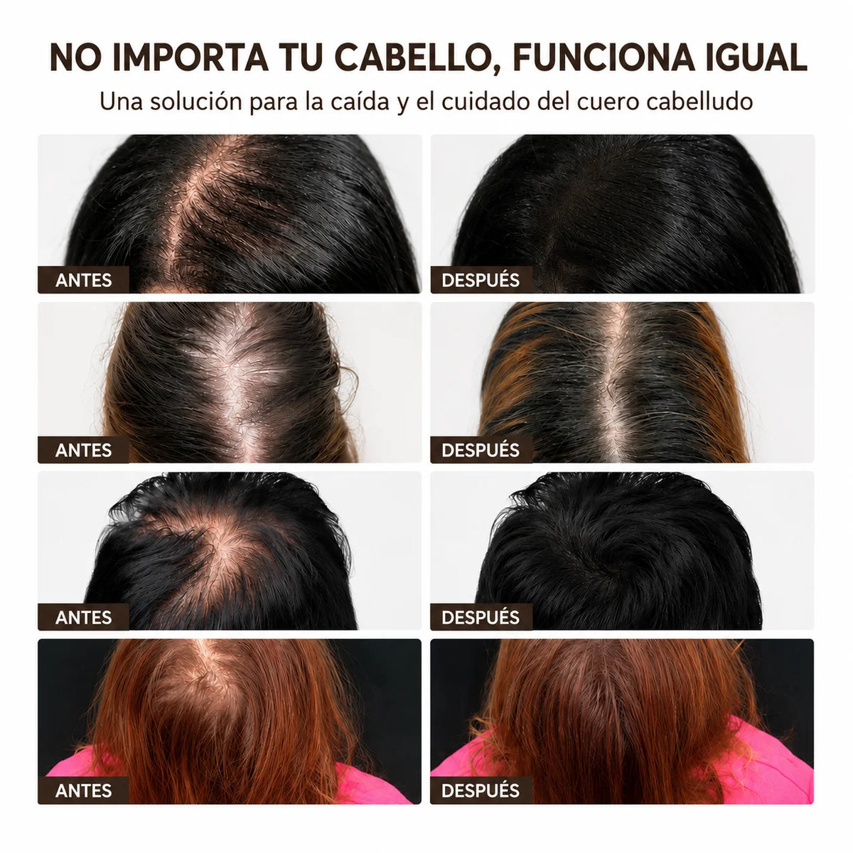 Sérum Coreano #1 Anticaída