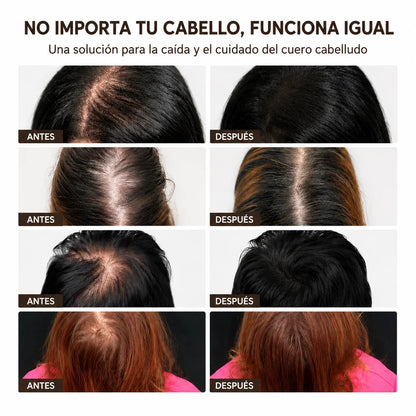 Sérum Coreano #1 Anticaída